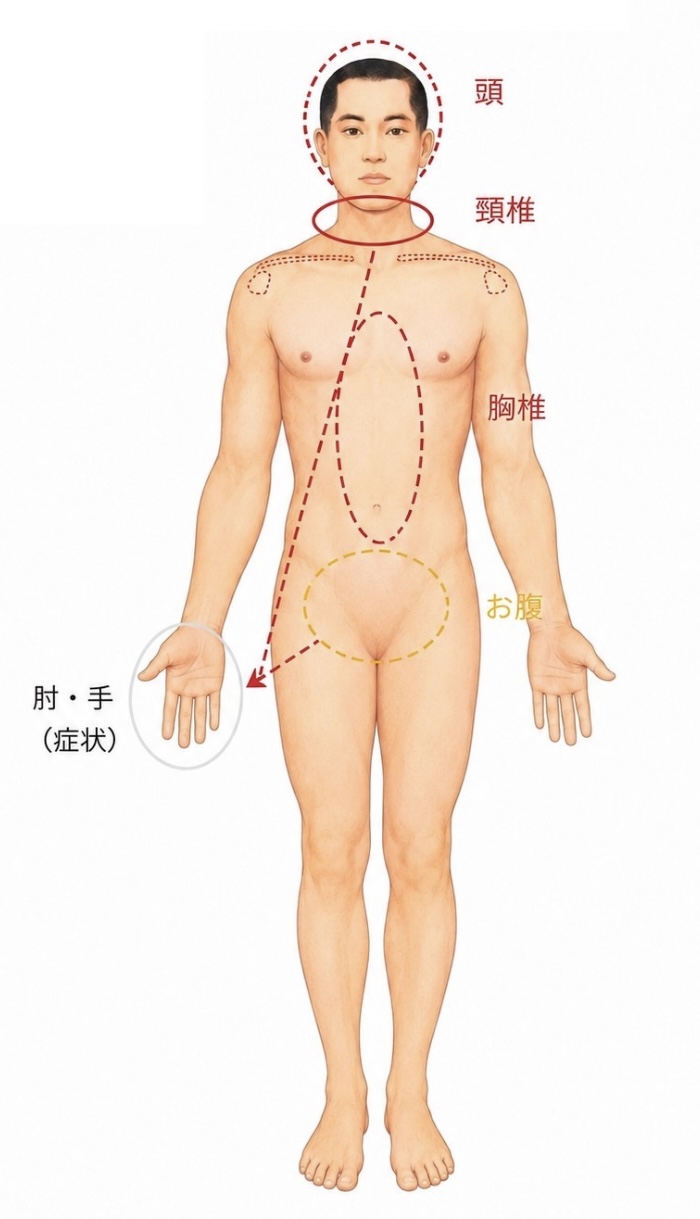 全身評価の図解（頭・頸椎・胸椎・お腹・肘・手の症状部位）